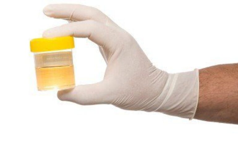 Drug Testing for Marijuana